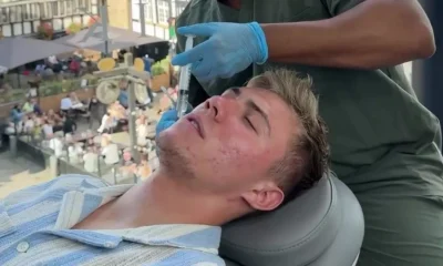 Man Utd star Rasmus Hojlund undergoes costly laser acne treatment after skin "blew up"